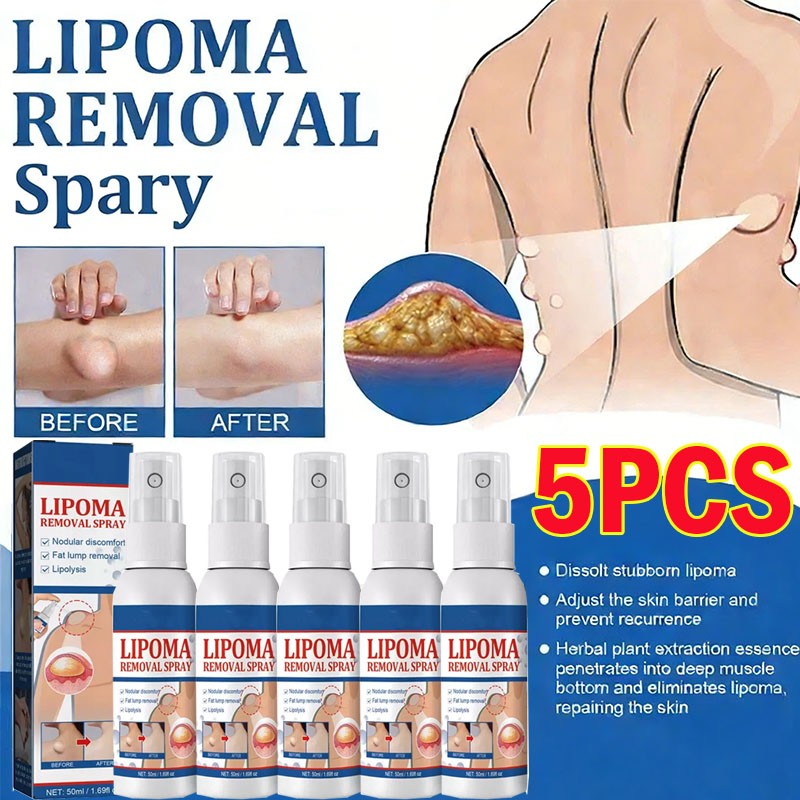 5X Lipomheilung Reduction Spray, Instant LumpFree Lipoma Removal Spray US