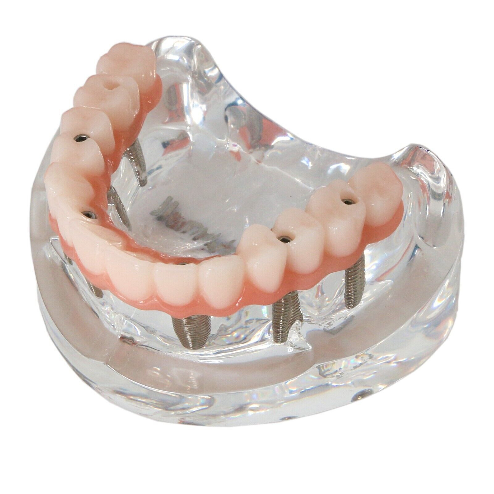Dental All-On-6 Overdenture Implant Model Demo Upper Jaw 6 Screws Clear M6001-2