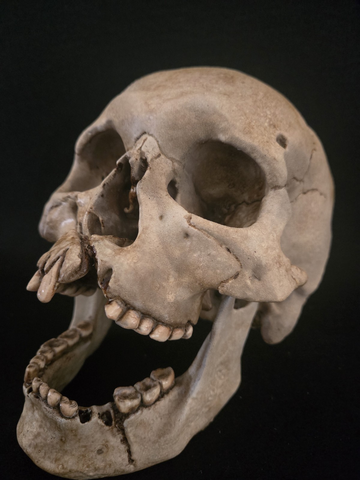 Human Skull Life Size Replica with battle wounds Realistic - Momento Mori