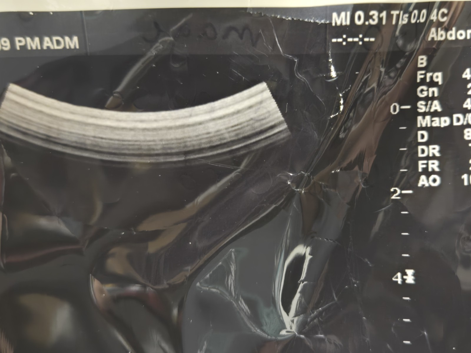 GE 4C Ultrasound Transducer Probe Convex Array used working condition