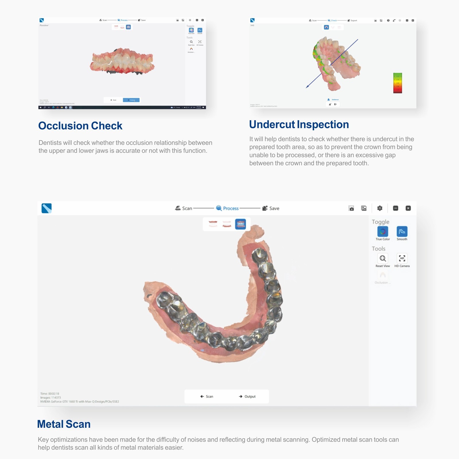 Dental Intraoral Scanner for CAD/CAM Dentistry Year:2025 w/ AI Software