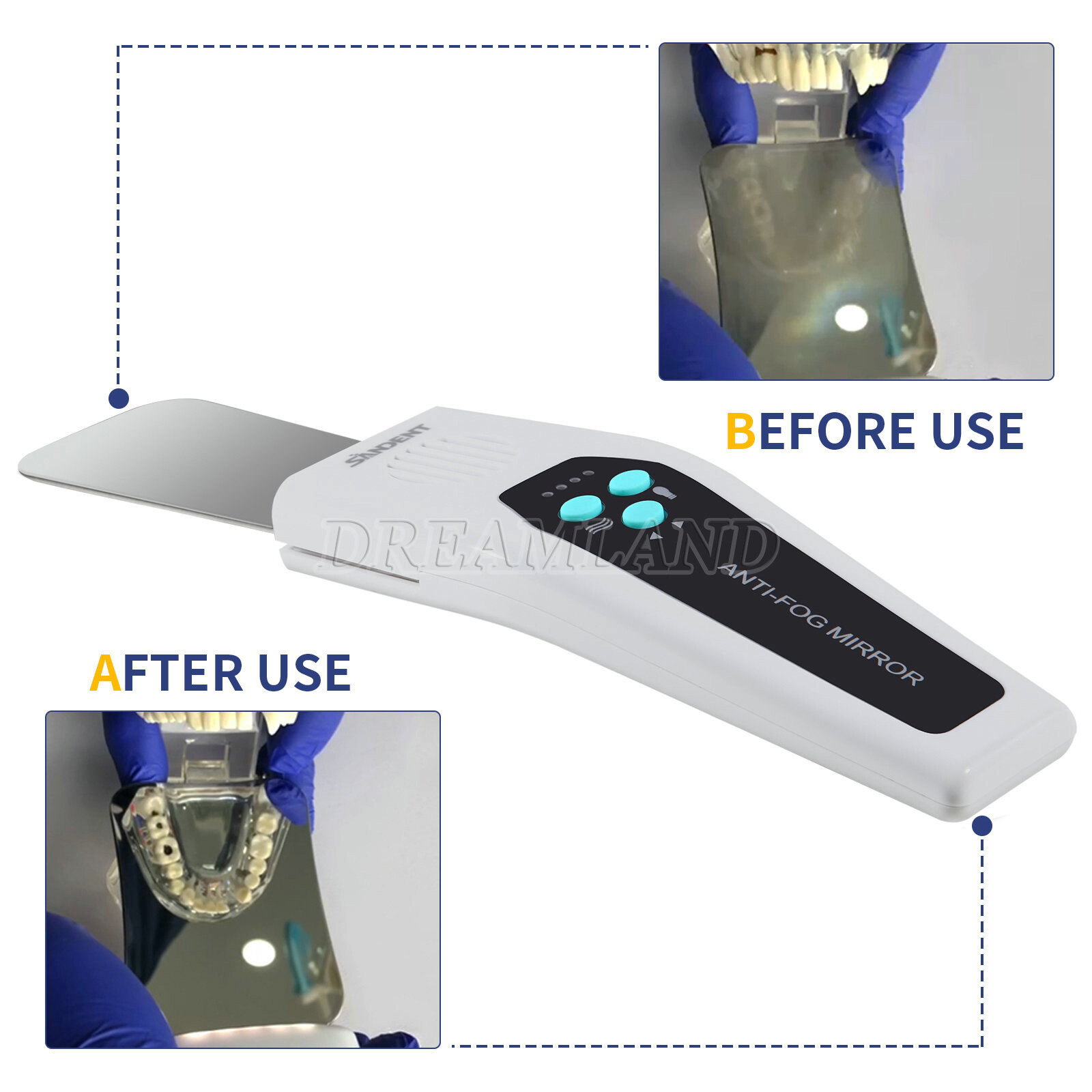 Dental Anti-fog Mirrors Photography Reflector No-Fog LED Automatic Mirrors Kit