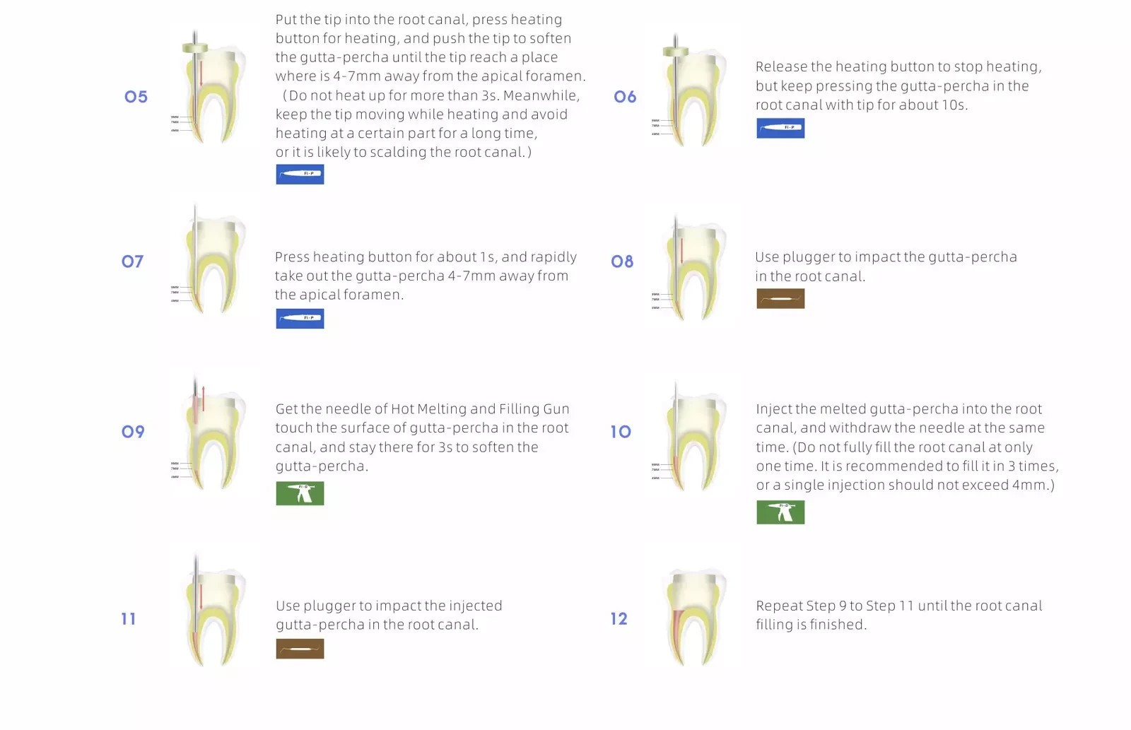 Woodpecker Cordless Dental Endo Gutta Percha Heated Pen/Gun Obturation System