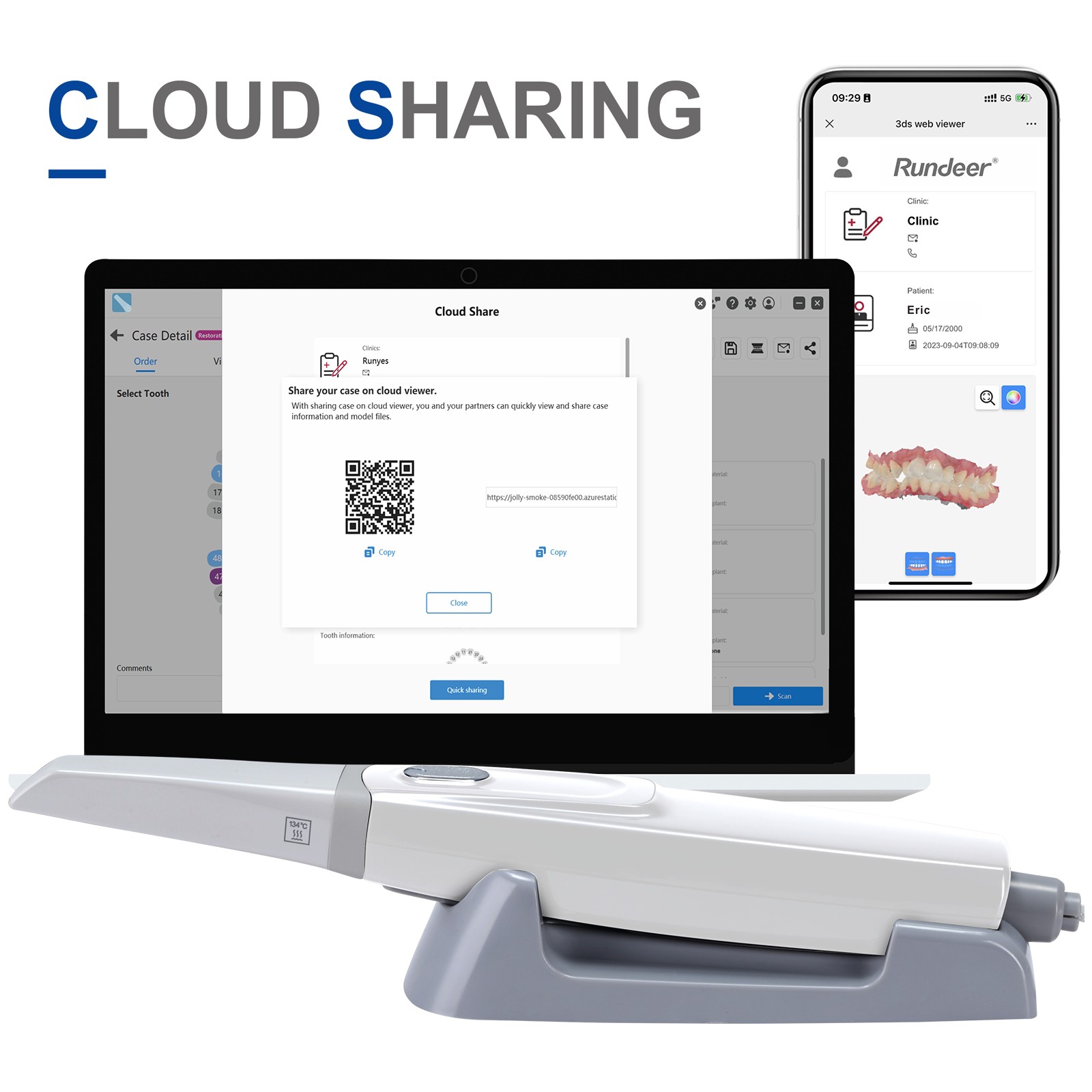 Dental Intraoral Scanner (free Shipping) for CAD/CAM Dentistry