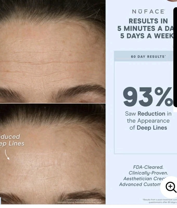 NuFace Effective Lip & Eye Trinity+ Attachment