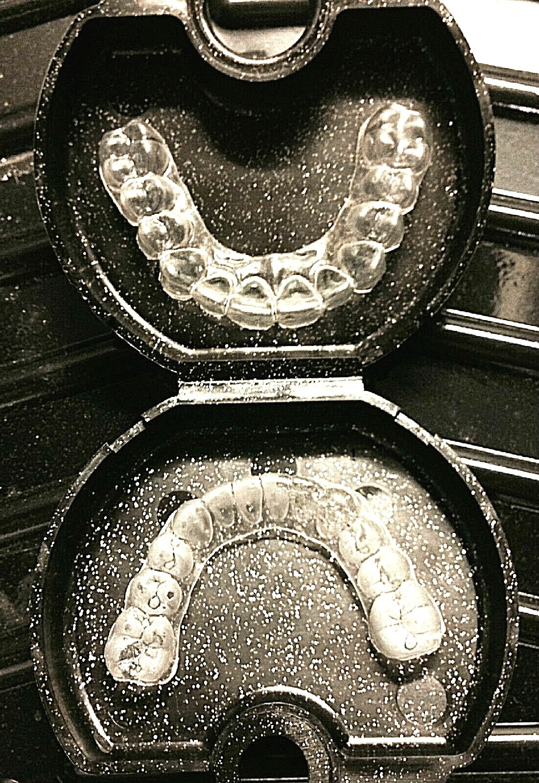 Custom Fit Set Orthodontic Dental Retainers~Upper AND Lower~MADE USA DENTAL LAB