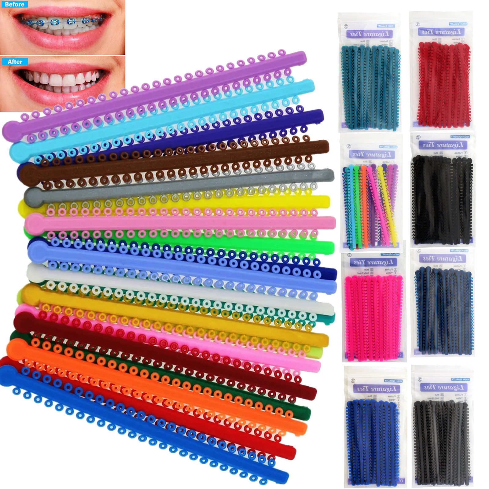 1000PCS Dental Orthodontic Ligature Ties Elastic Rubber Bands Braces Ligadura
