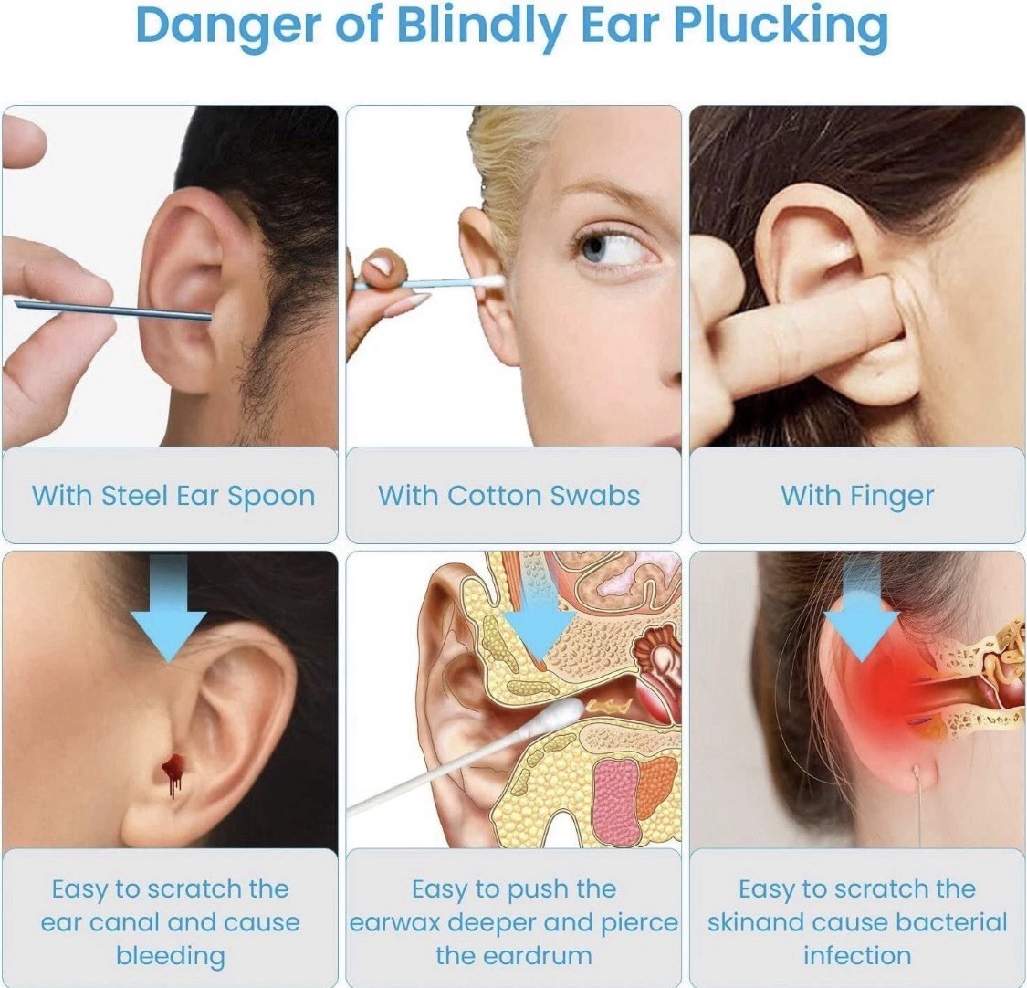 Wireless Ear Wax Removal Tool Camera HD Visual Otoscope Earpick