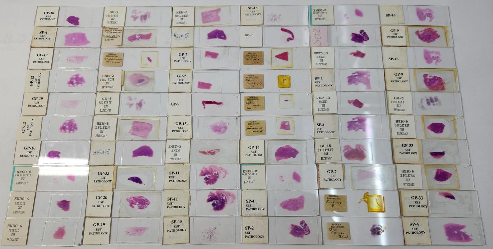 Lot Of 50 Vintage University Prepared Pathology Microscope Slides - Slides Only