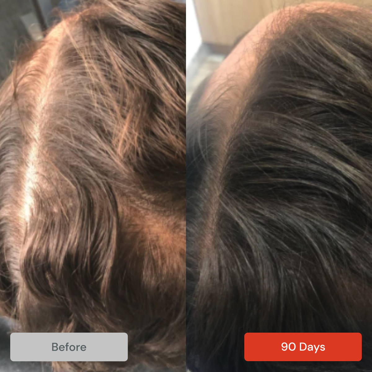 Men's Hair Loss Kit by DS Laboratories Including Revita S&C and Spectral DNC-N