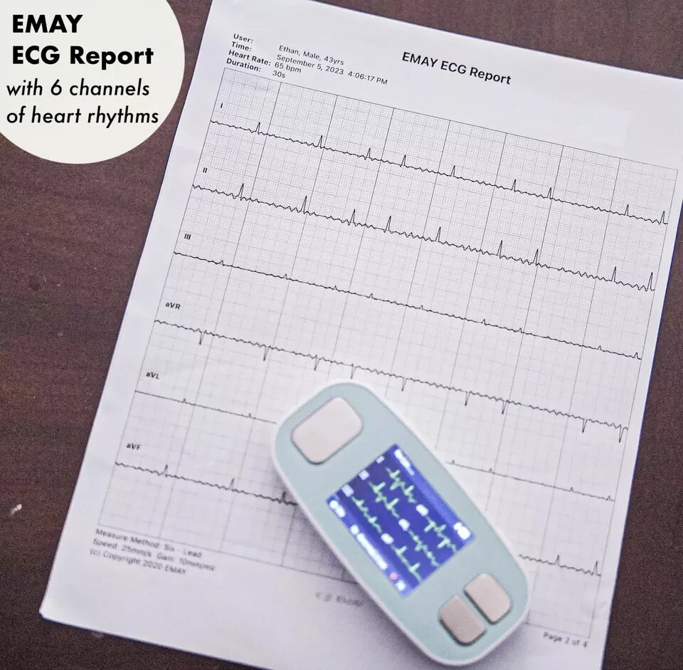 EMAY 6Leads Portable ECG Monitor Record ECG & Heart Rate in 6 Channels /OPEN BOX