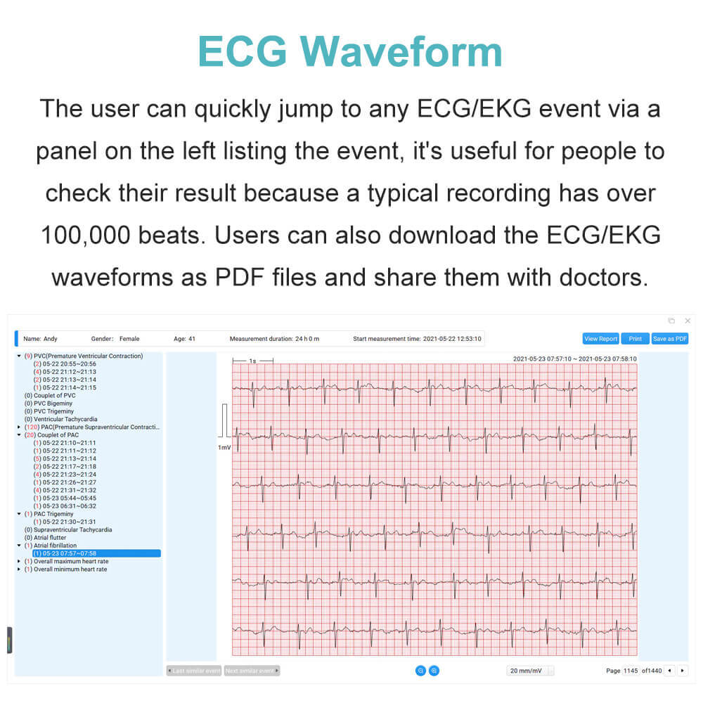 Holter Monitor 24 hours EKG Monitor ECG Recording PC Software Free AI Analysis