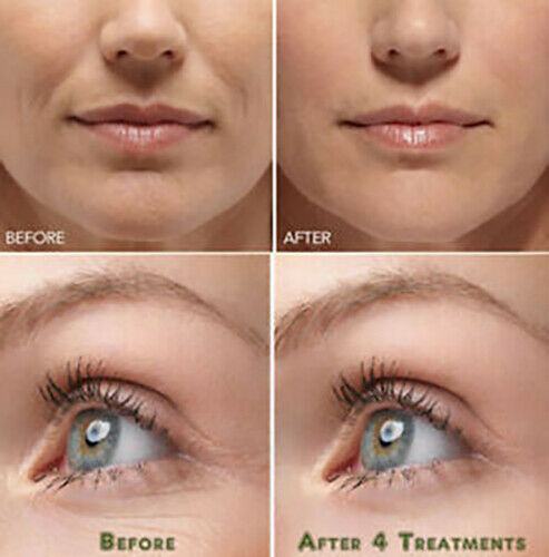 HYALURONIC ACID 100% Pure Anti Aging Hydrating Serum, Plumps Wrinkles Fine Lines