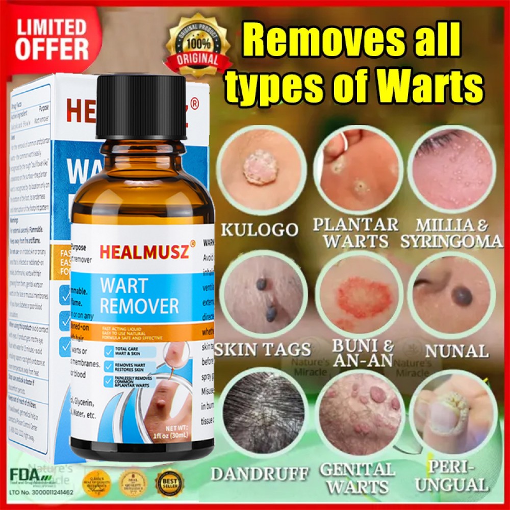 Wart Remover Liquid Skin Tag Mole Remover Eliminate Feet Corn Wart Remove Liquid