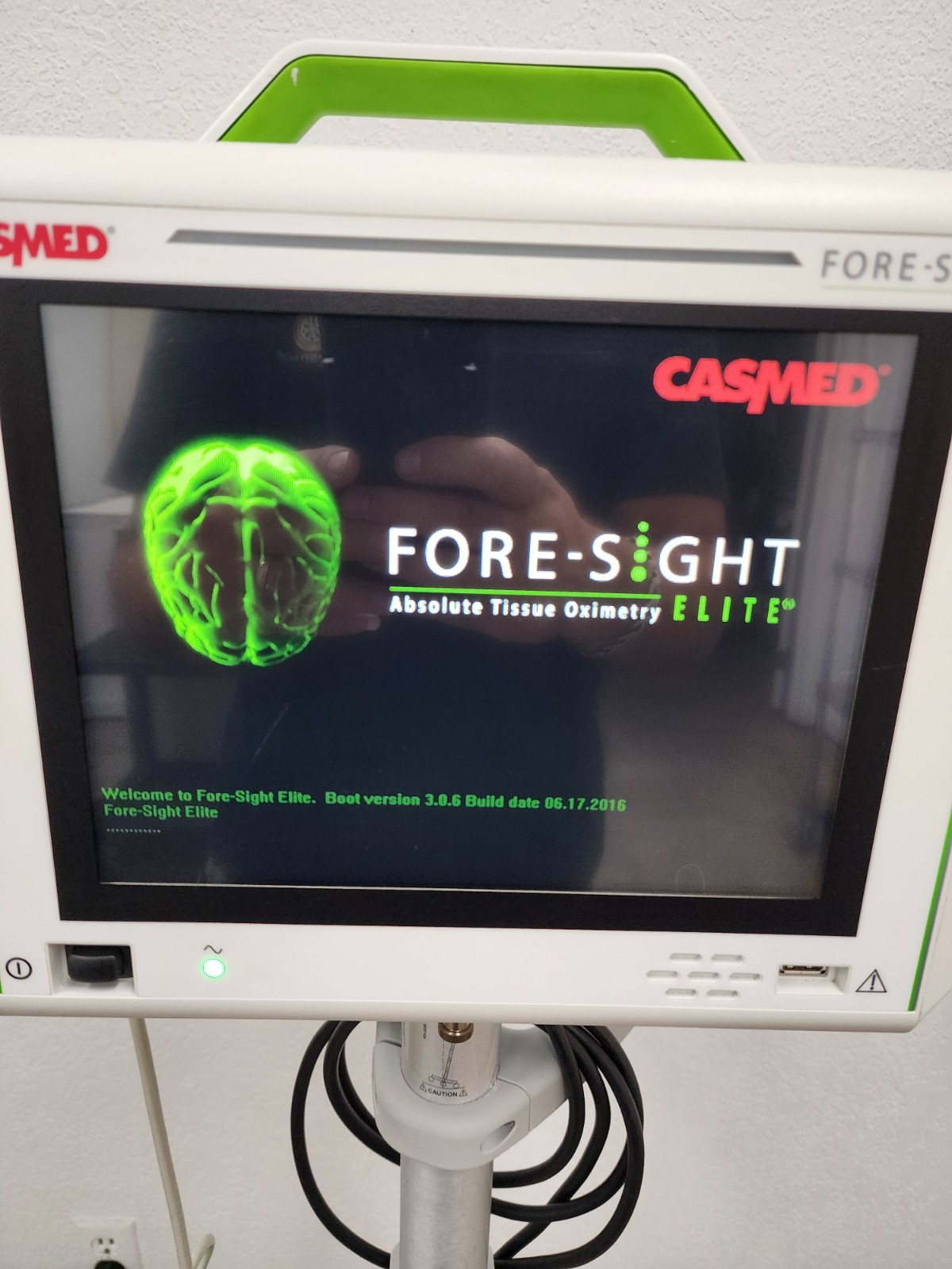 CasMed 01063000 Fore-Sight Elite Absolute Tissue Oximeter with Roller Stand