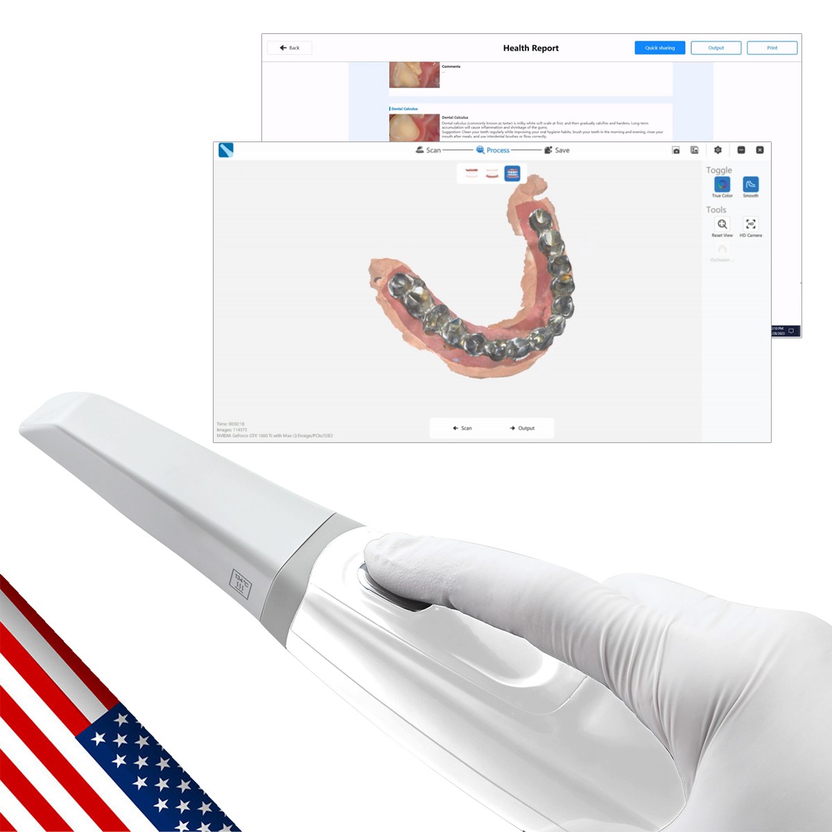 Dental Intra-oral Scanner 3D Real-time Display Software GreatLife w/Scanning SW