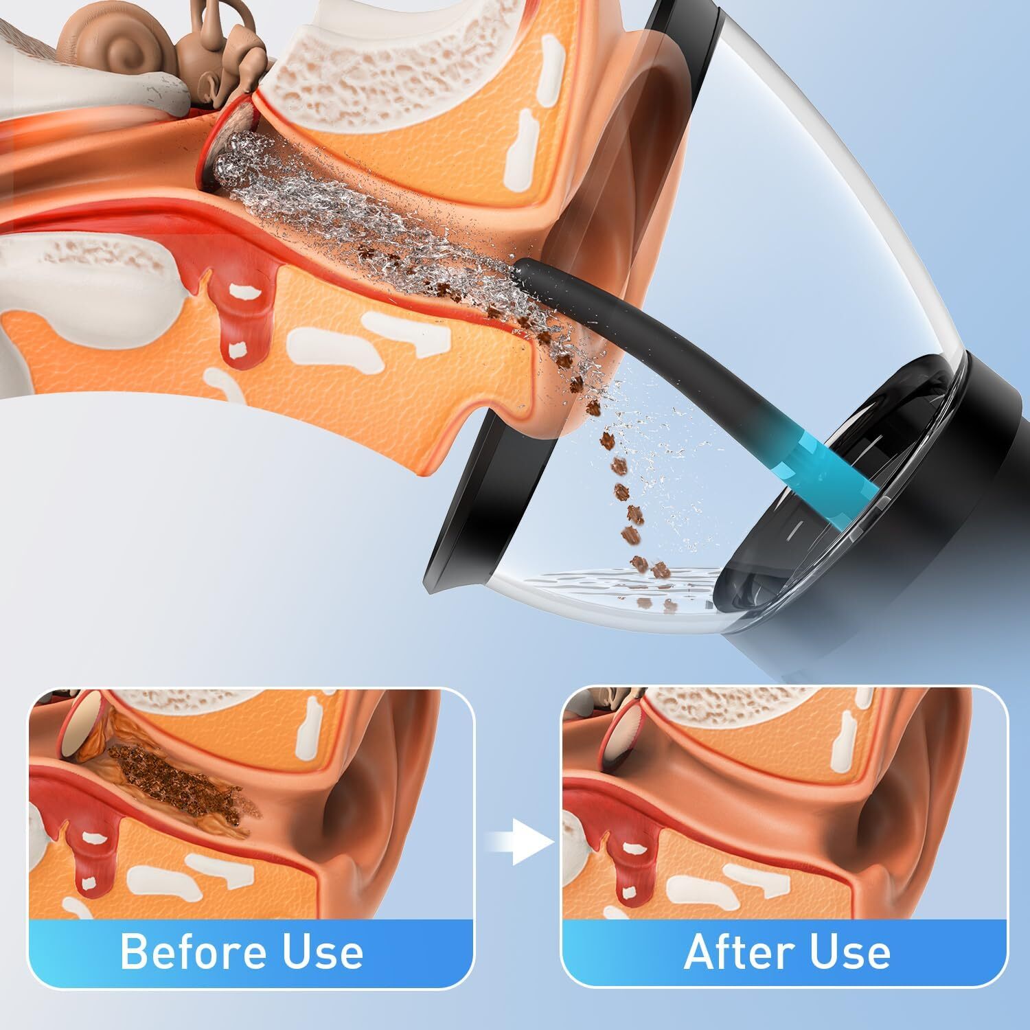 Electric Ear Wax Removal Retractable Water Ear Wax Cleaner Kit IPX6 ,4 Modes