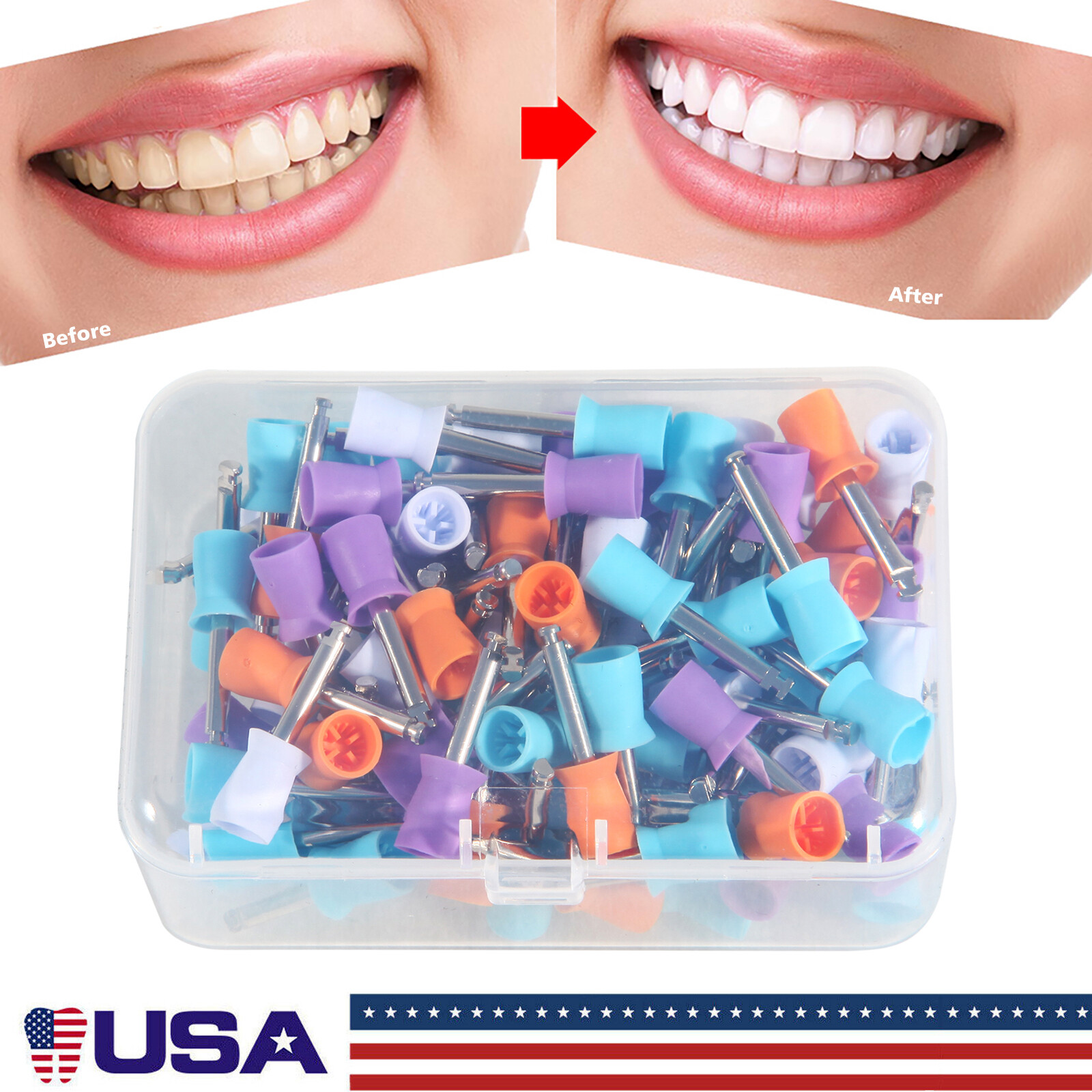 100-1000*Dental Rubber Prophy Tooth Teeth Polish Polishing Cups Latch Type Brush
