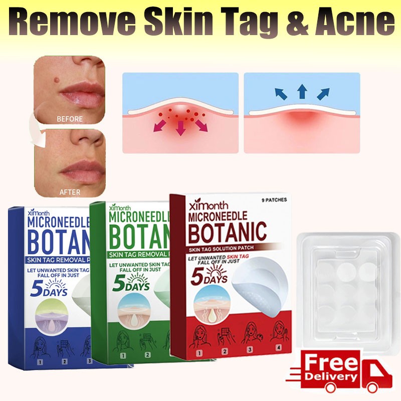 MICRONEEDLE BOTANIC Skin Tag & Acne Patch Skin Tag Remover Patches 9Pcs HOT 2026