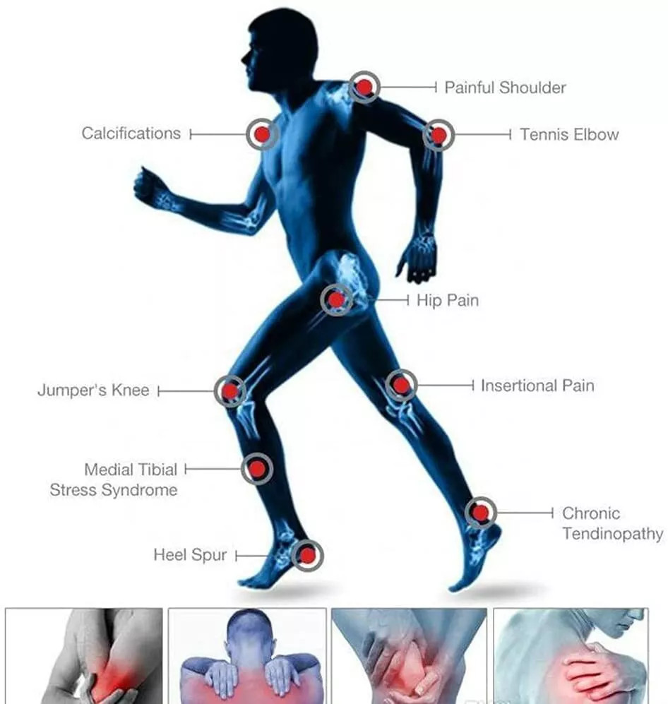 ED Shockwave Therapy Machine Muscle Pain Relief Erectile Dysfunction Treatment