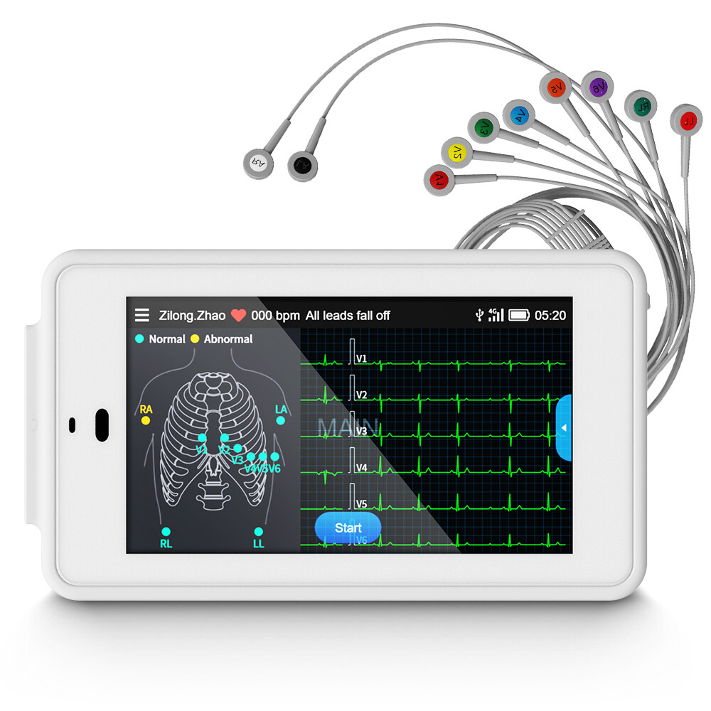 NEW 6/12-lead Electrocardiograph ECG EKG Machine + Glasgow ECG Interpretation