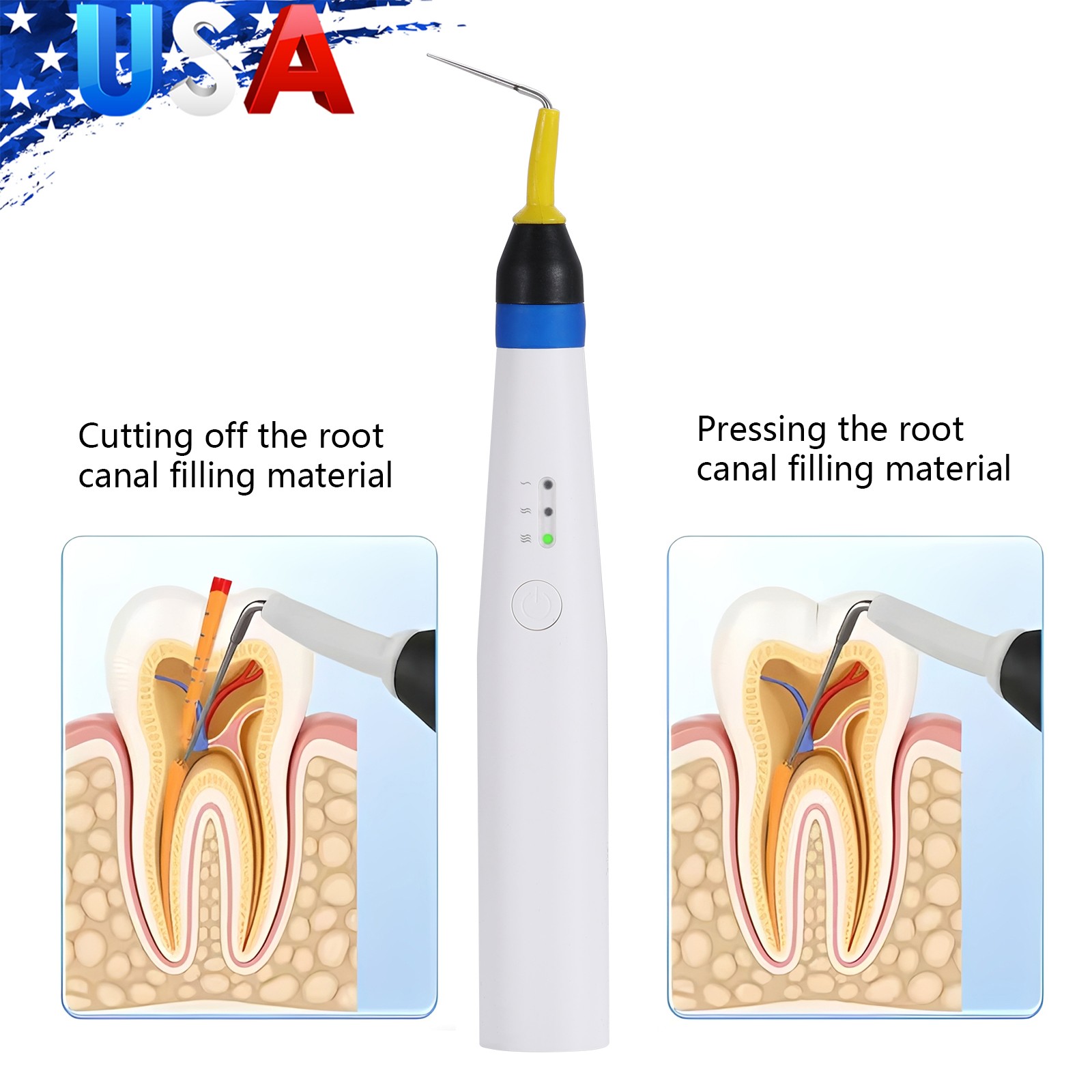 USA Dental Gutta Percha Obturation System Endo Heated Pen Cordless with 2Pc Tips