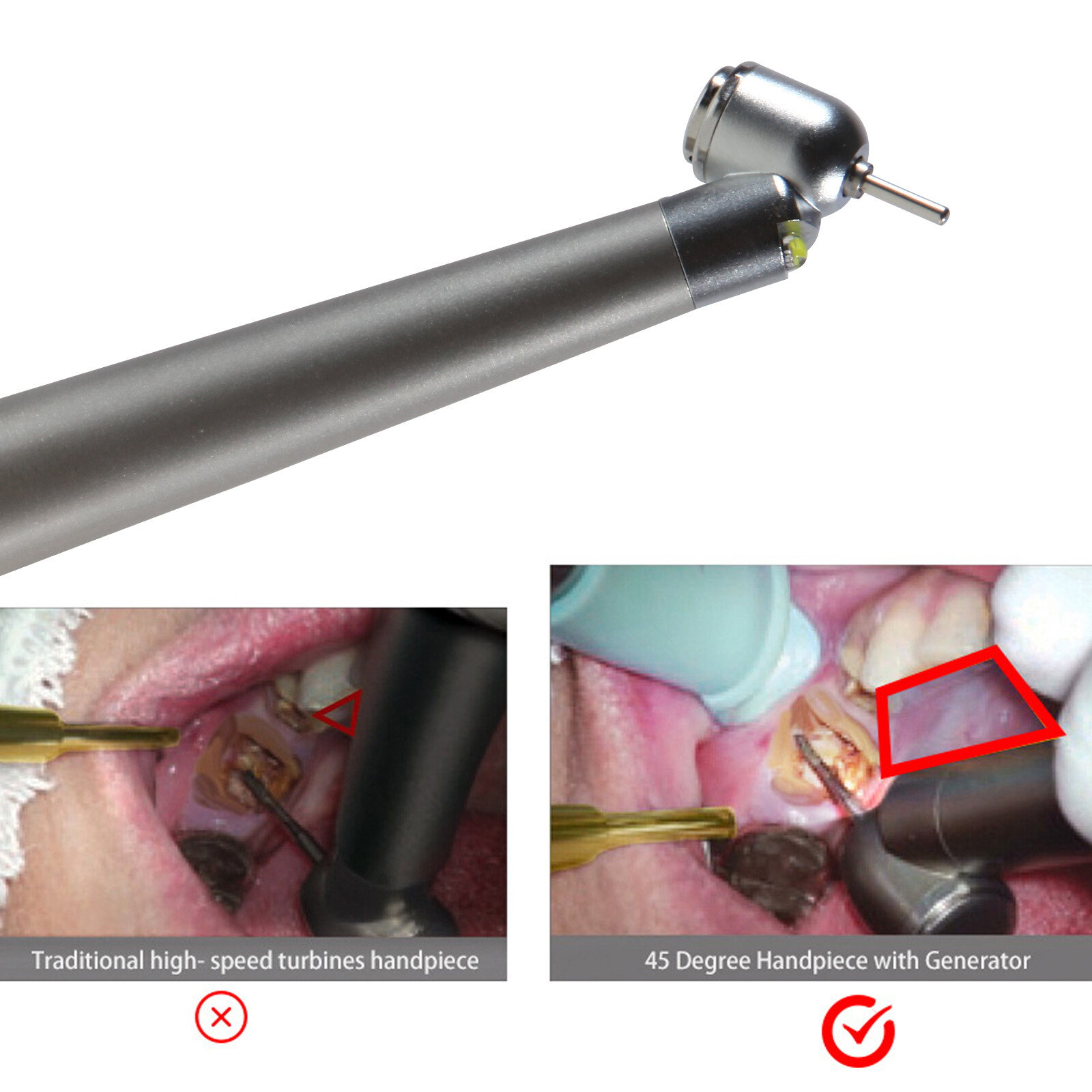 NSK Style Dental Surgical 45° Degree LED High Speed Handpiece Turbine 2 Holes