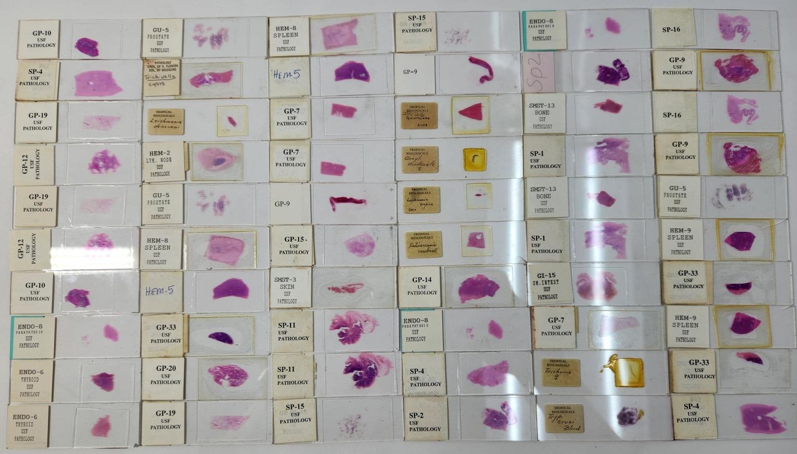 Lot Of 50 Vintage University Prepared Pathology Microscope Slides - Slides Only