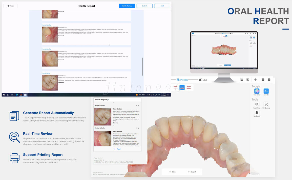 Dental Intra-oral Scanner 3D Real-time Display Software GreatLife w/Scanning SW