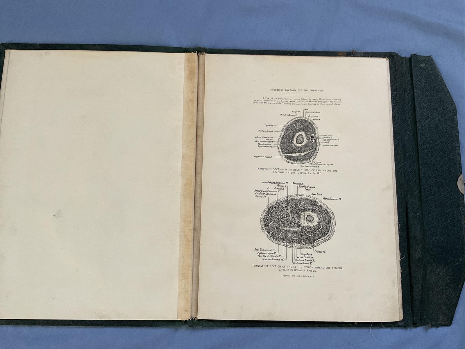 Antique Medical Anatomy Book Embalmer Anatomy Book Binder 1903