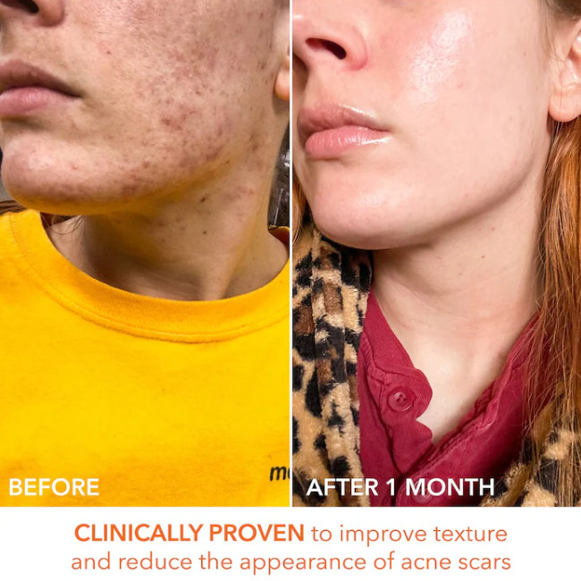 NIB 100%AuthenticDr. Dennis Gross Skincare Mini Alpha Universal Daily Peel Pads