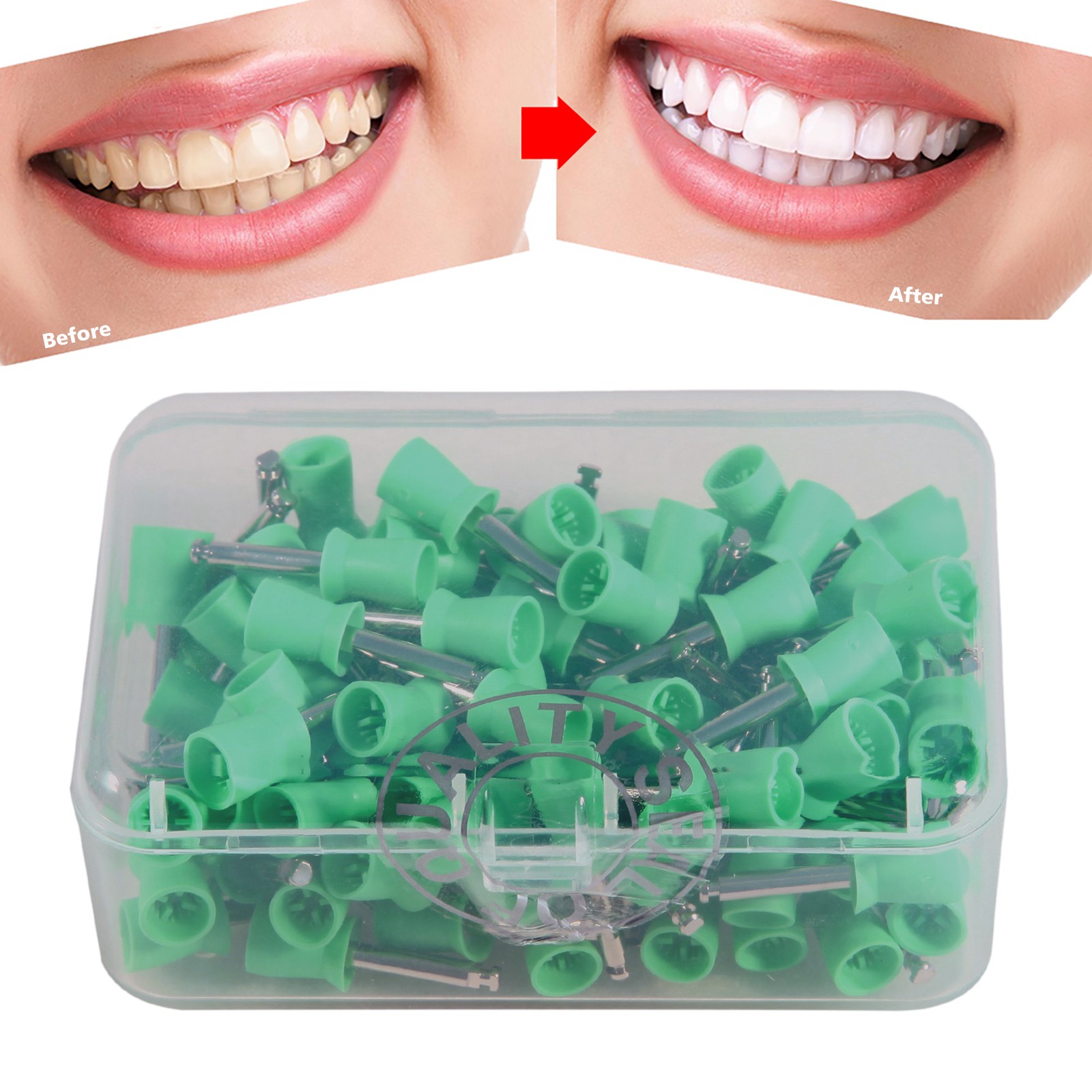 Dental Latch type Prophy Polishing Cups Polisher Rubber Polish Brushes green ad