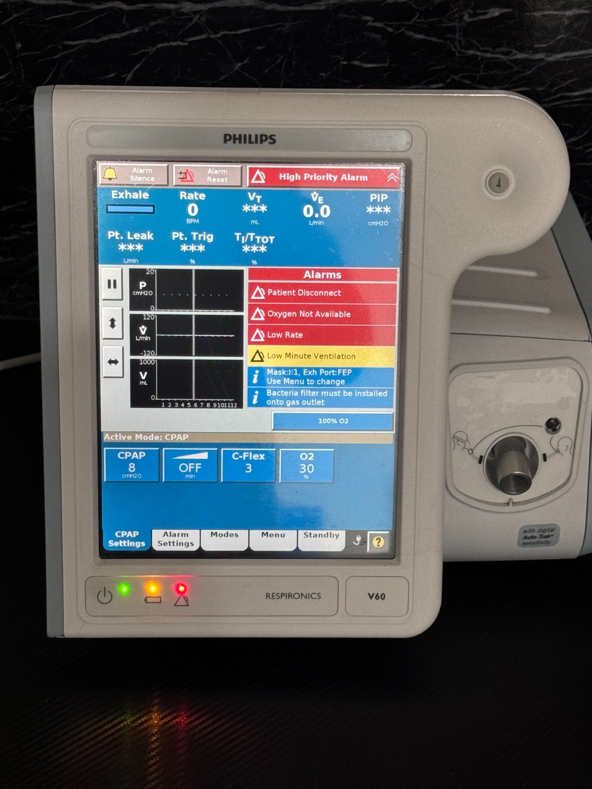 Philips V60 System 1033544