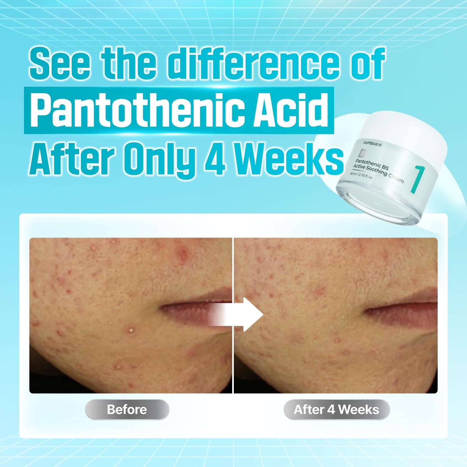 Numbuzin No.1 Pantothenic B5 Active Soothing Cream - Sebum & Trouble Care