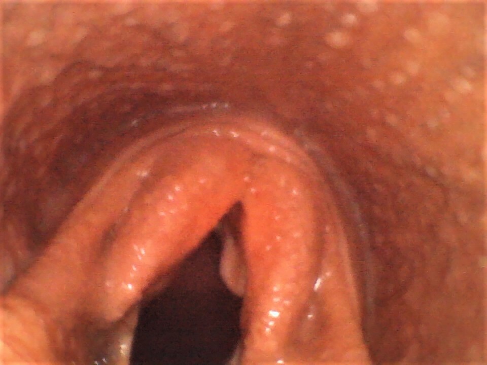 Vividia VE-8150 Portable Joystick Veterinary Horse Equine Upper Airway Endoscope