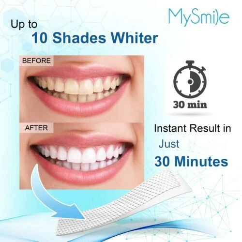 MySmile 28pc 6%HP Teeth Whitening Strips Non Sensitive Tooth Whitener Kit