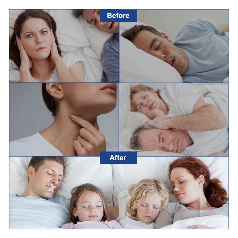 Mouth Tape Strips – Comfortable Nasal Breathing Night
