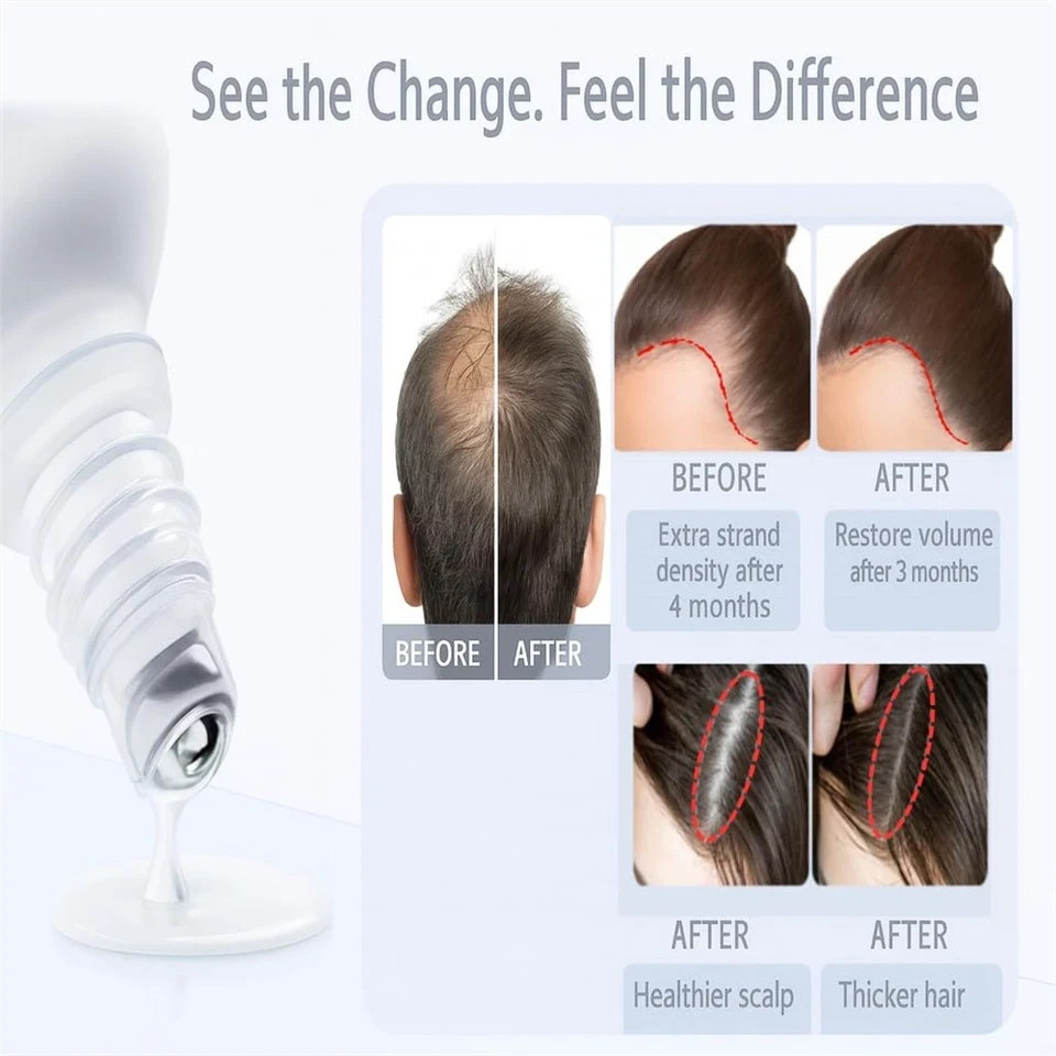 Be Bodywise Hair Growth Serum Roll On - 3% Rosemary, 3% Redensyl & 2% - 25ml