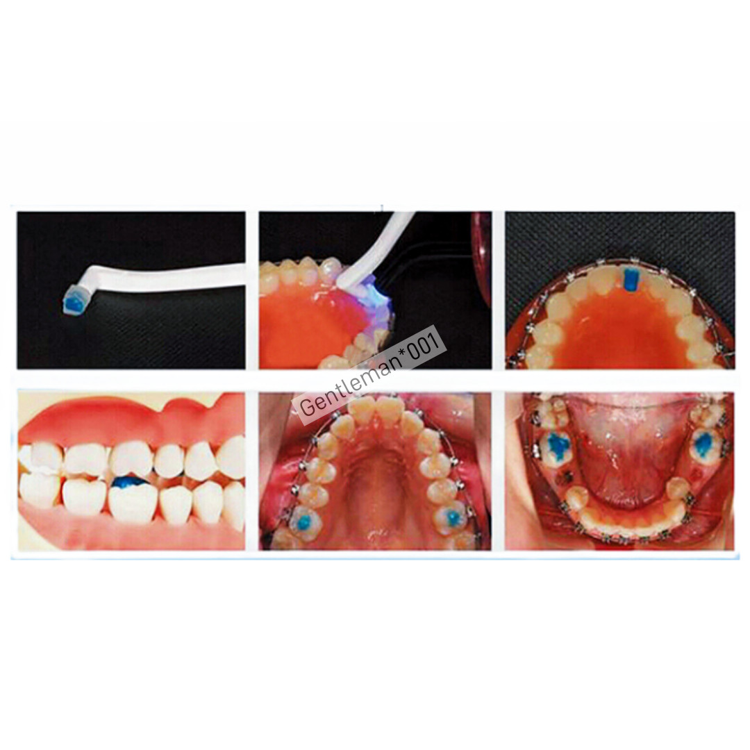 Dental Orthodontic Brackes Bonding Adhesive Light Cure Band Cement Blue Paste 5g