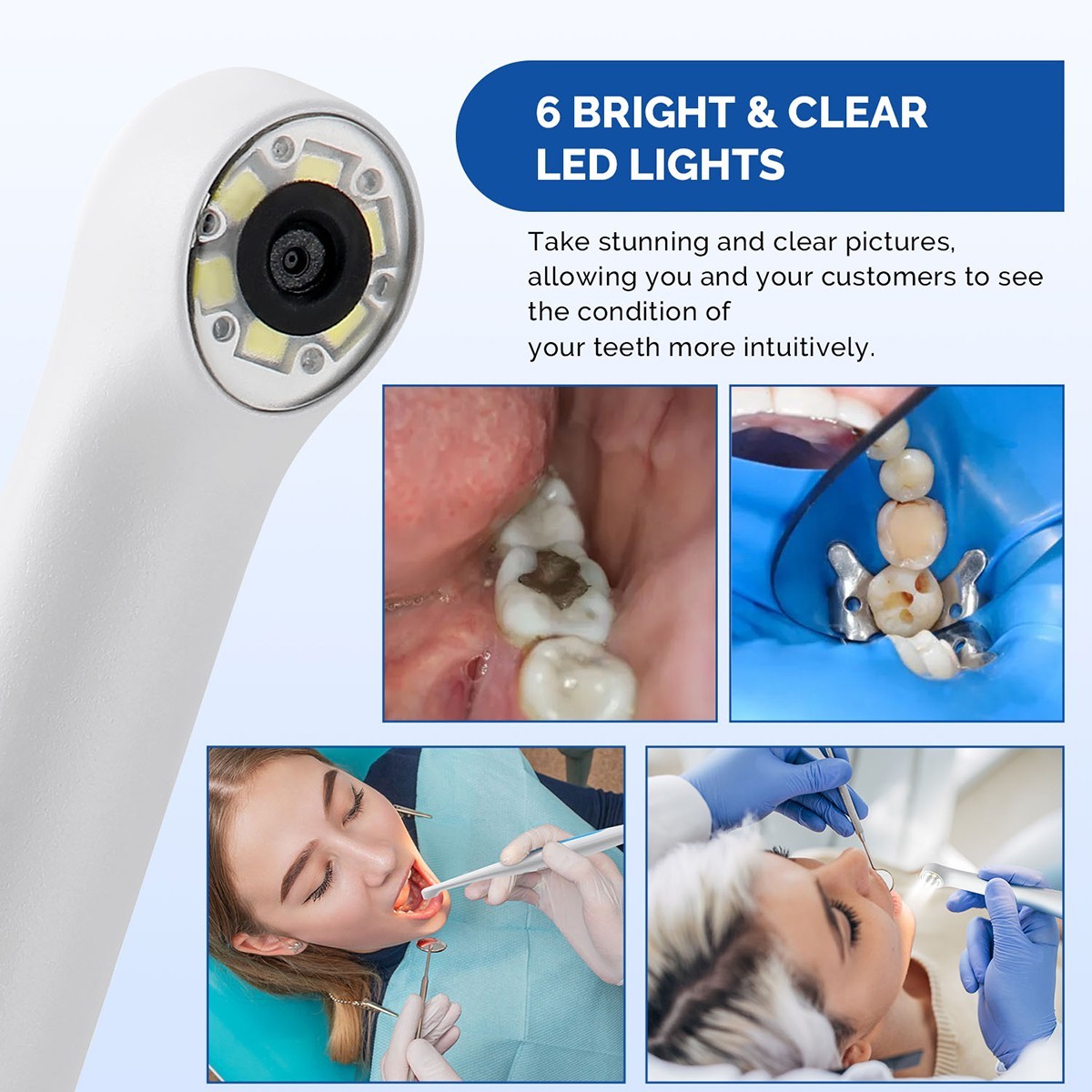 Dental Intraoral Camera Image Sensor 1280*720P Automatic For Dexis/Eaglesoft