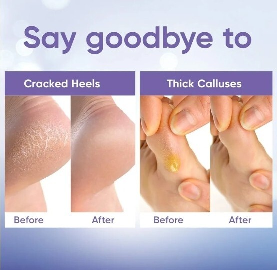 2 Pairs Exfoliating Foot Peel Mask Baby Soft Feet Remove Dead Skin Calluses