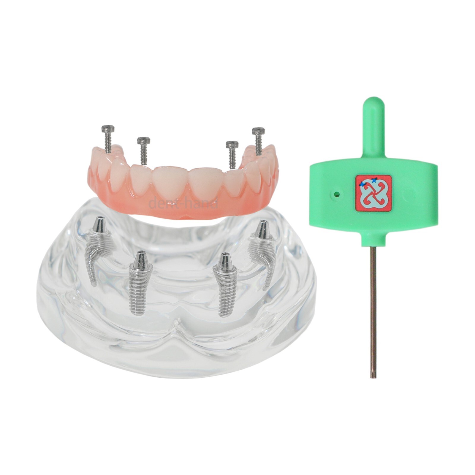 Dental Upper/Lower 4 Implants Demo Implant Teeth Model Restoration Overdenture