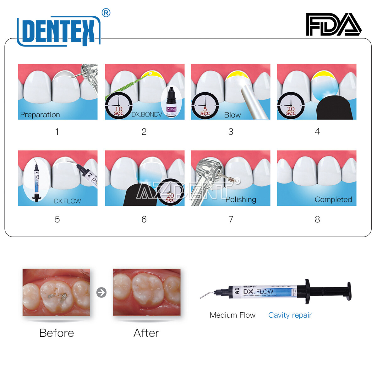 DX.FLOW Dental Flowable Light Cure Composite Resin Medium Flow DENTEX