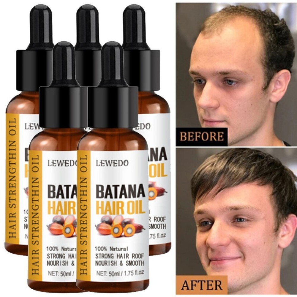 100% Pure Herbal Hair Growth Oil Shampoo Anti hair Loss Hair Regrowth Treatment