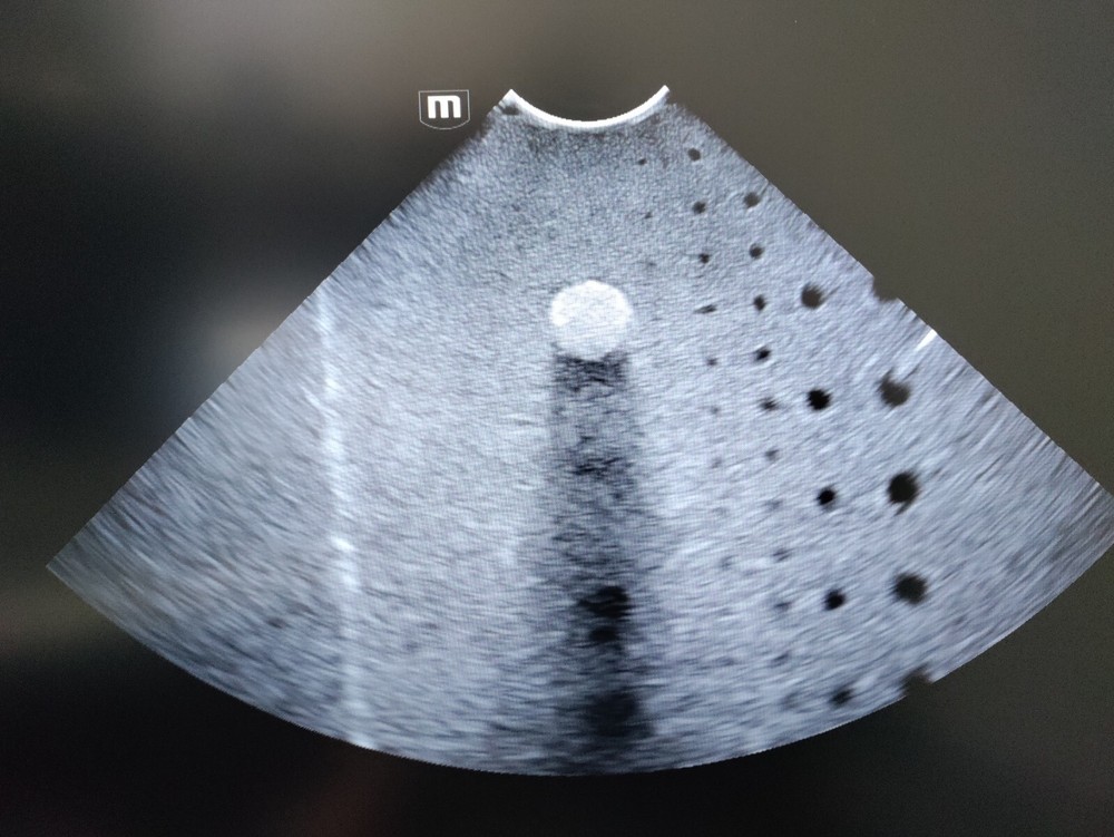 Mindray C6-2Gs Convex Array Ultrasound Probe Great Condition!