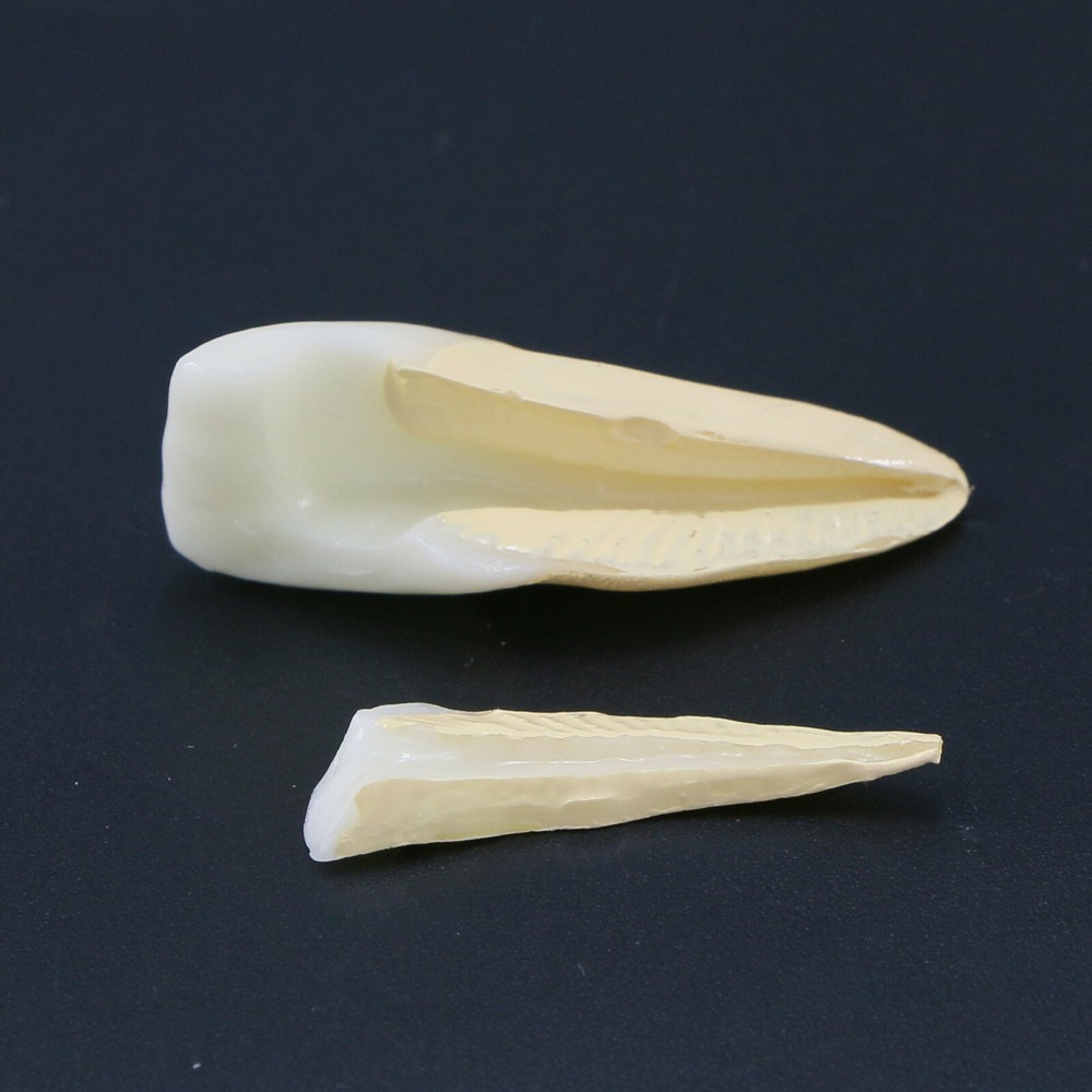 Endodontic Treatment Root Canal Tooth Teach Study Dental Teeth Removable Model