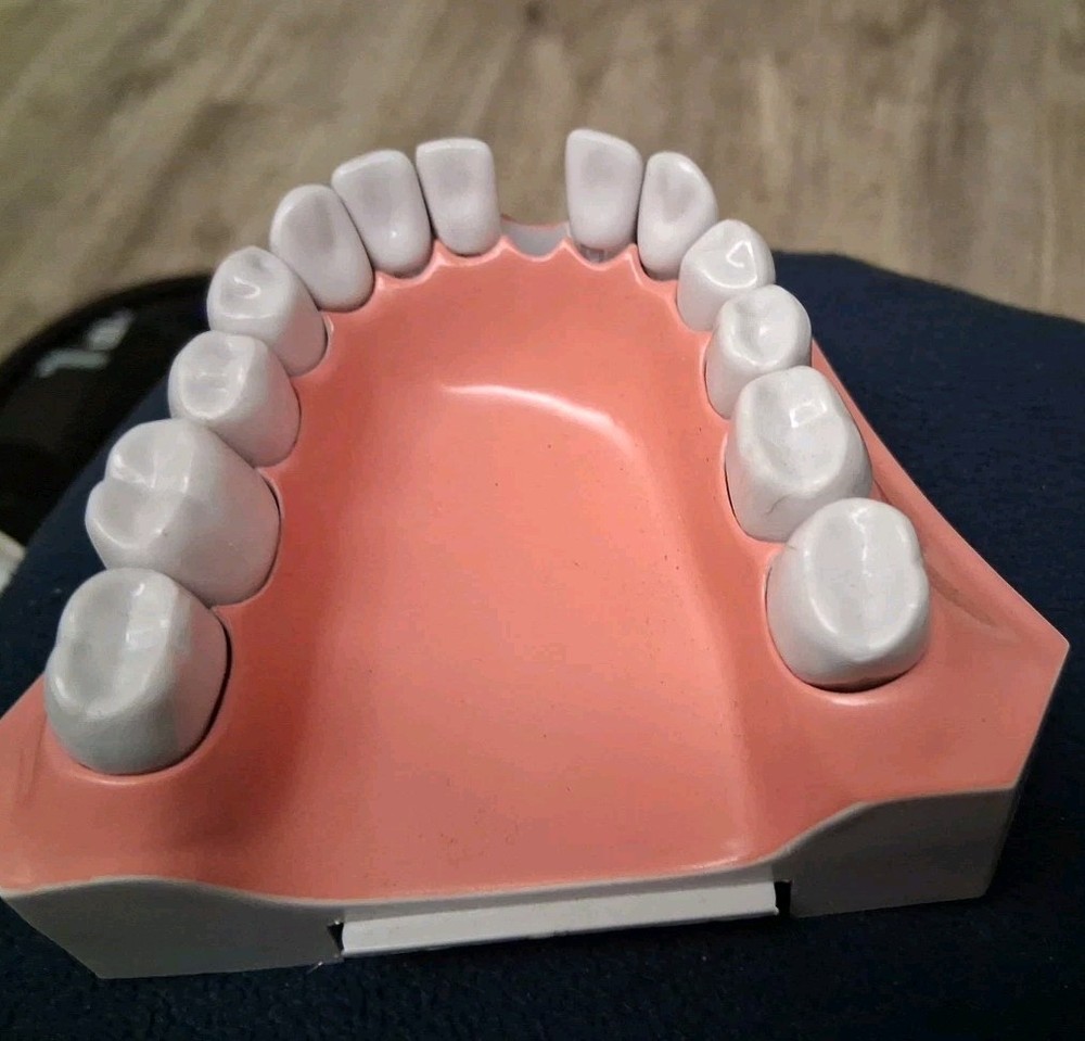 Bottom Teeth Model With Removable Teeth One Missing