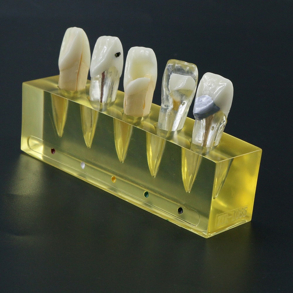 Endodontic Treatment Root Canal Tooth Teach Study Dental Teeth Removable Model