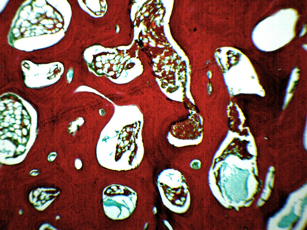 Spongy Bone Section (Mammal), Prepared Microscope Slide - 75x25mm - Eisco Labs