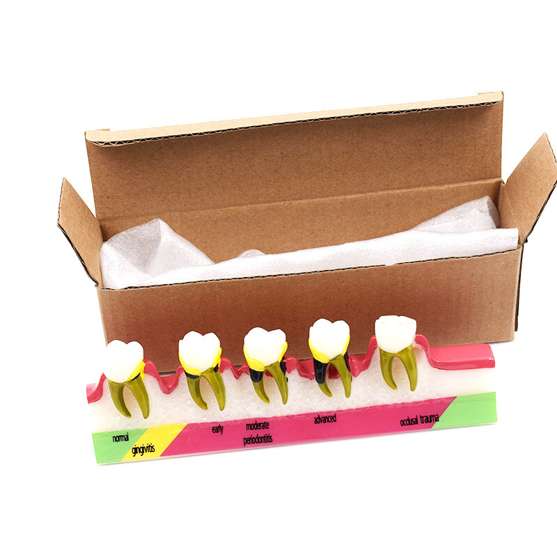 Dental High Quality Assort Dentoform Pathological Study Periodontal Model Teeth